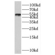WB analysis of A375 cells, using SLC30A6 antibody (1/500 dilution).
