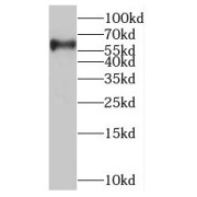 WB analysis of MCF-7 cells, using SLC37A1 antibody (1/600 dilution).