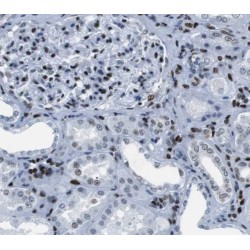 Solute Carrier Family 37 Member 4 (SLC37A4) Antibody