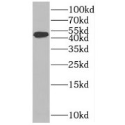 WB analysis of mouse liver tissue, using SLC37A4 antibody (1/1000 dilution).