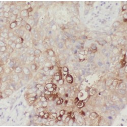 Solute Carrier Family 38 Member 3 (SLC38A3) Antibody