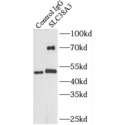 Solute Carrier Family 38 Member 3 (SLC38A3) Antibody