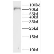 Western blot analysis of mouse brain tissue, using SLC5A3 antibody (1/300 dilution).