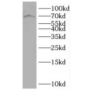 WB analysis of mouse brain tissue, using SLC7A4 antibody (1/300 dilution).