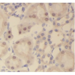 Schlafen-Like Protein 1 (SLFNL1) Antibody