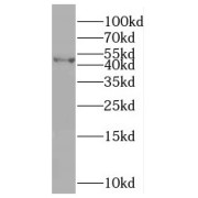 WB analysis of COLO 320 cells, using SLFNL1 antibody (1/800 dilution).