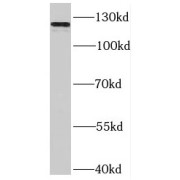 WB analysis of mouse brain tissue, using SLITRK3 antibody (1/200 dilution).