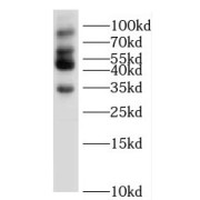 WB analysis of mouse heart tissue, using SLMAP antibody (1/600 dilution).