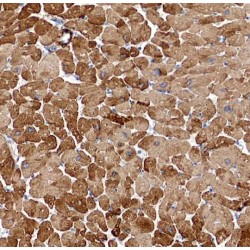 Sarcolipin (SLN) Antibody