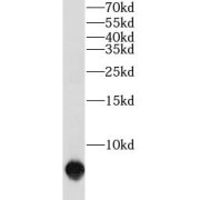 WB analysis of human heart tissue, using SLN antibody (1/300 dilution).