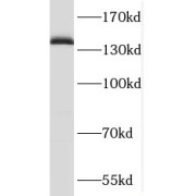 WB analysis of mouse brain tissue, using SLTM antibody (1/500 dilution).