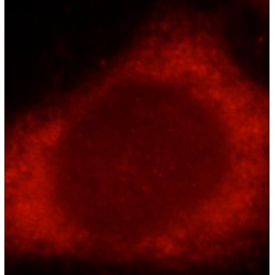 Mothers Against Decapentaplegic Homolog 3 (SMAD3) Antibody