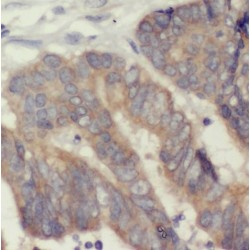 Mothers Against Decapentaplegic Homolog 3 (SMAD3) Antibody