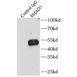 Mothers Against Decapentaplegic Homolog 5 (SMAD5) Antibody