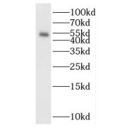 WB analysis of K-562 cells, using SMAD5 antibody (1/1000 dilution).