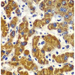 Mothers Against Decapentaplegic Homolog 9 (SMAD9) Antibody