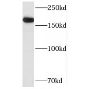 WB analysis of HepG2 cells, using SMARCA5 antibody (1/800 dilution).