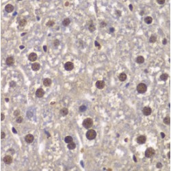 SWI/SNF-Related Matrix-Associated Actin-Dependent Regulator of Chromatin Subfamily B Member 1 (SMARCB1) Antibody