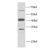 WB analysis of HeLa cells, using SMARCB1 antibody (1/1000 dilution).