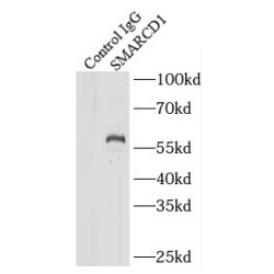 SWI/SNF Related, Matrix Associated, Actin Dependent Regulator of Chromatin, Subfamily D, Member 1 (SMARCD1) Antibody