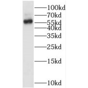 WB analysis of mouse brain tissue, using SMARCD1 antibody (1/600 dilution).