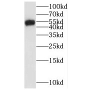 WB analysis of RAW264.7 cells, using SMARCD2 antibody (1/500 dilution).