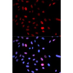 Structural Maintenance of Chromosomes 1A (SMC1A) Antibody