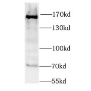 WB analysis of HeLa cells, using SMC1A antibody (1/1000 dilution).