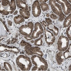 Structural Maintenance of Chromosomes Protein 4 (SMC4) Antibody