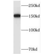 WB analysis of MCF-7 cells, using SMC4 antibody (1/2000 dilution).