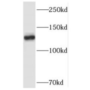 WB analysis of HeLa cells, using SMC5 antibody (1/500 dilution).