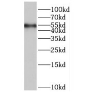 WB analysis of HEK-293 cells, using SMEK2 antibody (1/500 dilution).