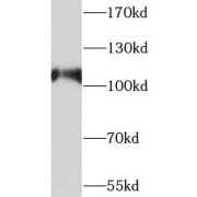 WB analysis of HeLa cells, using SMG5 antibody (1/600 dilution).