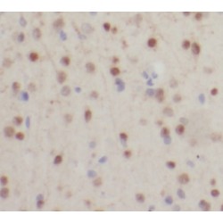 Survival Motor Neuron Protein (SMN) Antibody