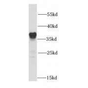 WB analysis of HeLa cells, using SMN2 antibody (1/1000 dilution).