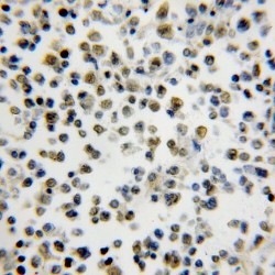 Survival of Motor Neuron-Related-Splicing Factor 30 (SMNDC1) Antibody