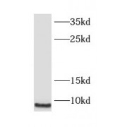 WB analysis of human skeletal muscle tissue, using SMPX antibody (1/400 dilution).