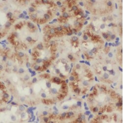 DNA Replication Regulator And Spliceosomal Factor (SMU1) Antibody