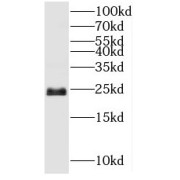 WB analysis of HepG2 cells, using SNAP23 antibody (1/1000 dilution).