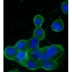 Synaptosomal-Associated Protein 25 (SNAP25) Antibody