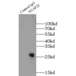 Synaptosomal-Associated Protein 25 (SNAP25) Antibody