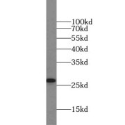 WB analysis of HEK-293 cells, using SNAP25 antibody (1/10000 dilution).