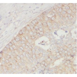 Beta-Synuclein (SNCB) Antibody