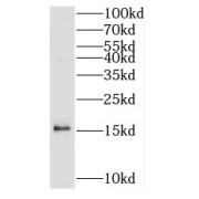 WB analysis of mouse brain tissue, using SNCB antibody (1/600 dilution).