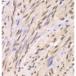 U1 Small Nuclear Ribonucleoprotein A (SNRPA) Antibody