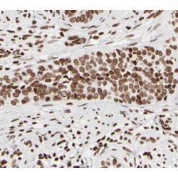 Small Nuclear Ribonucleoprotein Polypeptide B2 (SNRPB2) Antibody