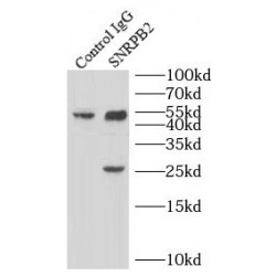 Small Nuclear Ribonucleoprotein Polypeptide B2 (SNRPB2) Antibody