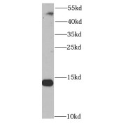 WB analysis of A2780 cells, using SNRPD2 antibody (1/1000 dilution).