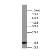 WB analysis of HeLa cells, using SNRPD2 antibody (1/1000 dilution).