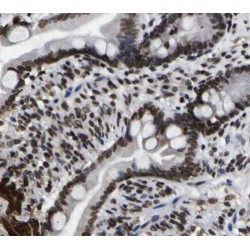 Small Nuclear Ribonucleoprotein D3 Polypeptide (SNRPD3) Antibody